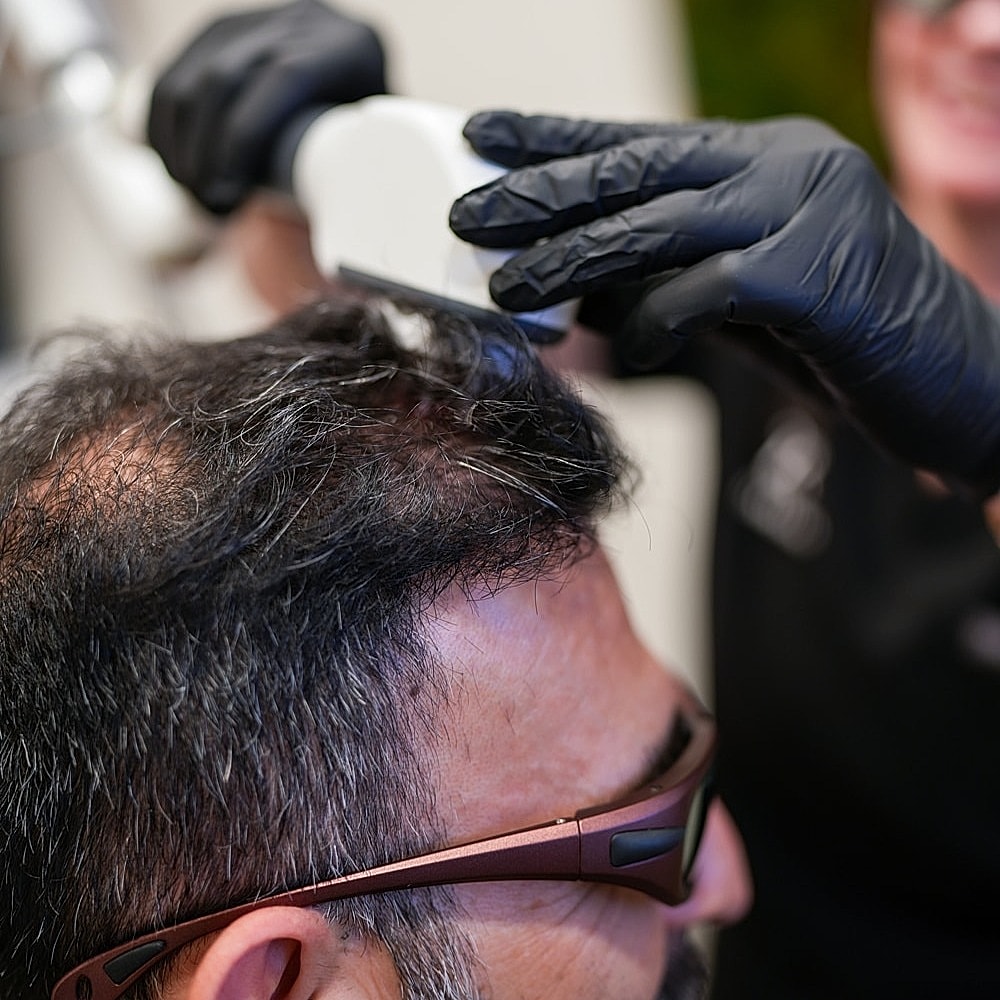 Hair treatment session with device and patient.