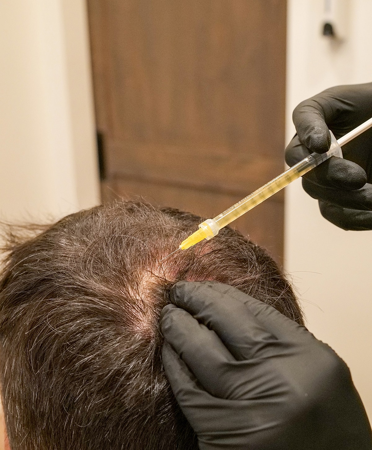 Hair treatment procedure being applied to scalp.