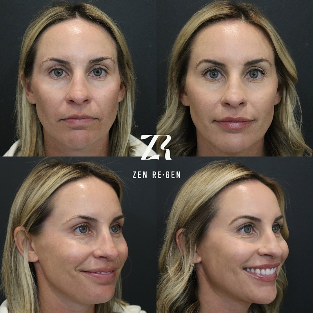 Before and after facial treatment transformations.