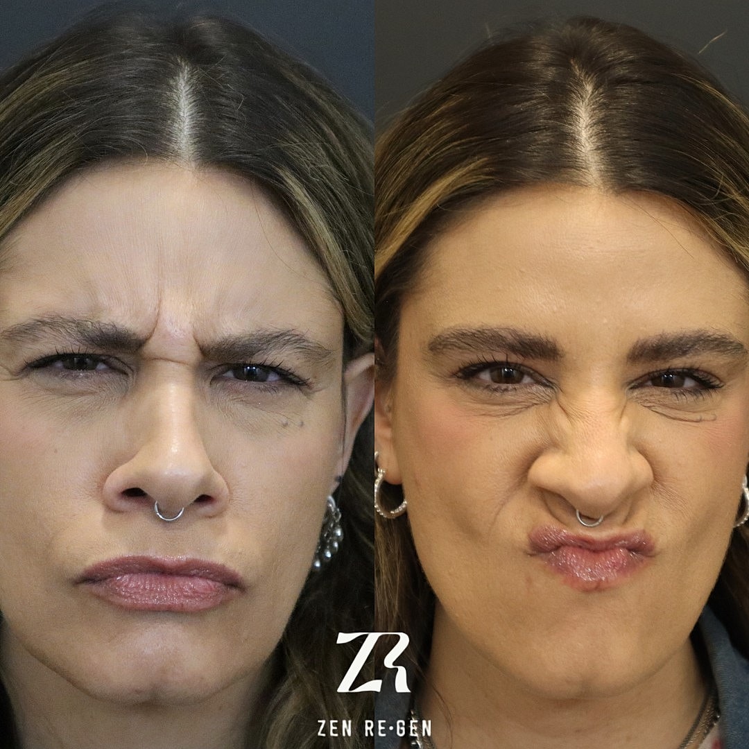 Contrasting facial expressions of two women.