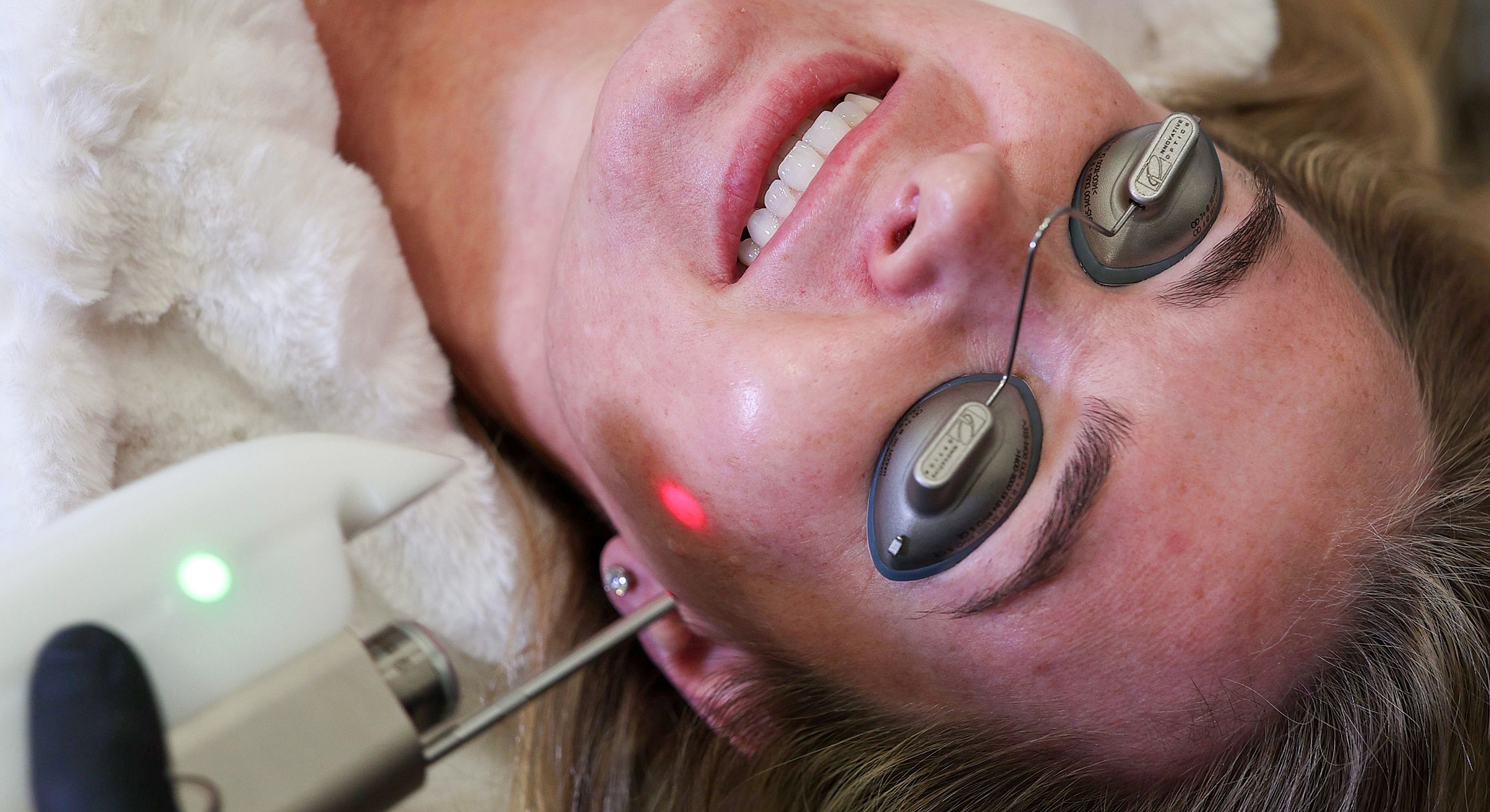 Laser treatment session on a woman's face.
